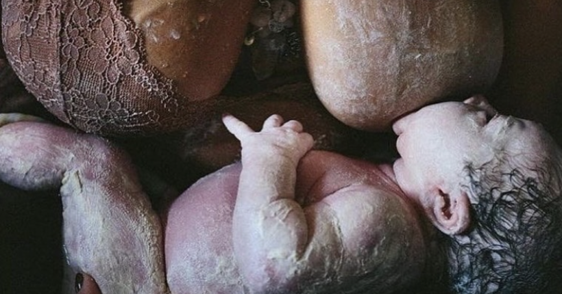 Neonatal